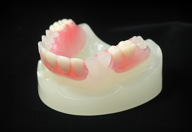 ノンクラスプデンチャー